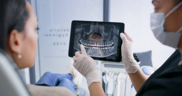 Licensed Tooth Extraction service in Athens, GA - Smile Center Dentistry